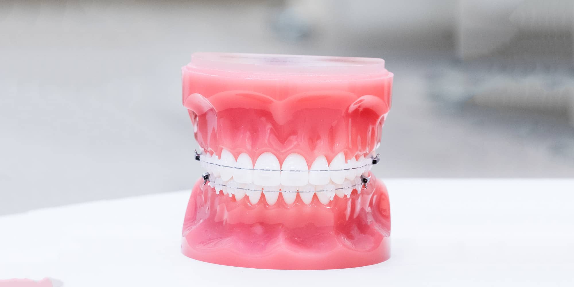Clear ceramic braces on a dental model
