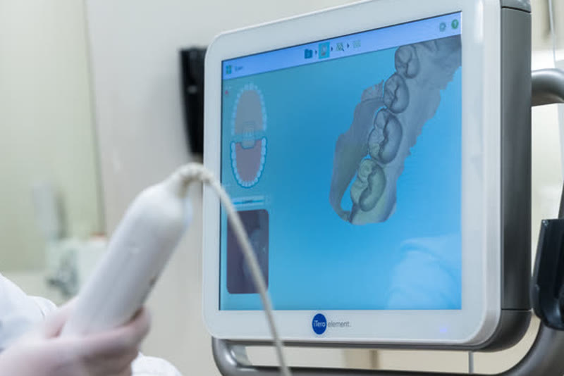 An iTero scanner displaying a 3D scan of a patient’s teeth